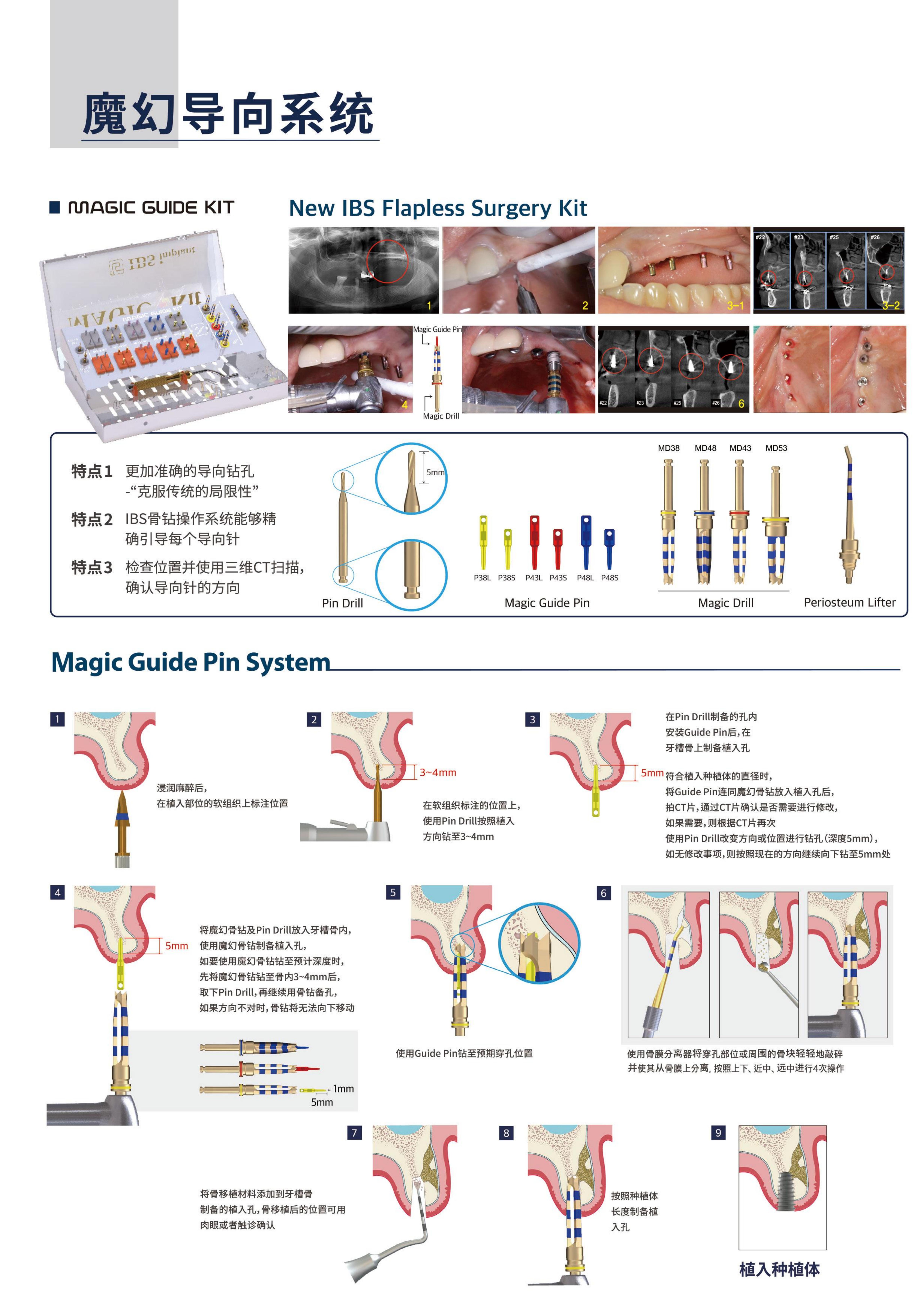 种植牙黑科技！IBS-FC种植体，重新定义缺牙修复
